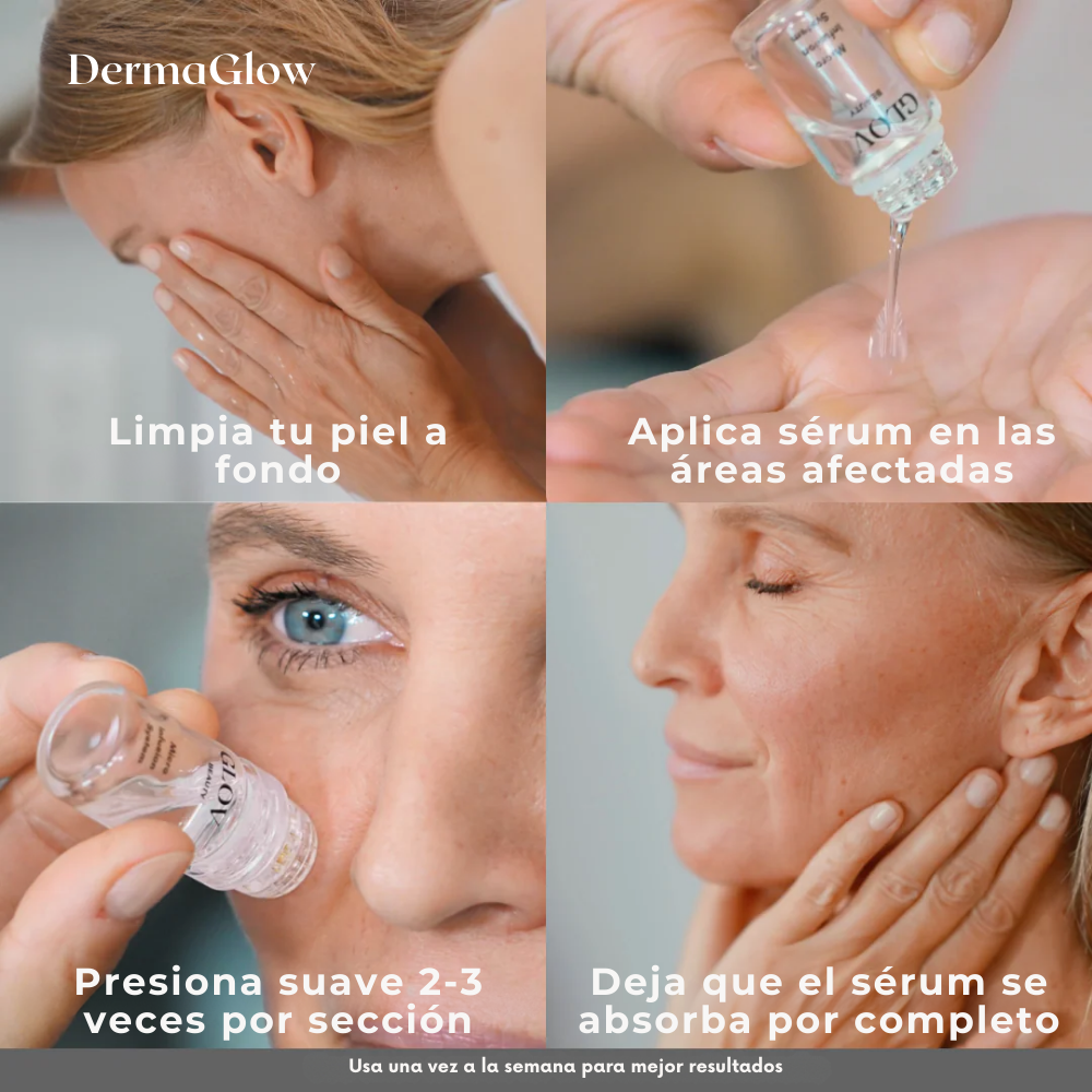 DermaGlow™ – Sistema Avanzado de Microinfusión Facial con ácido hialurónico