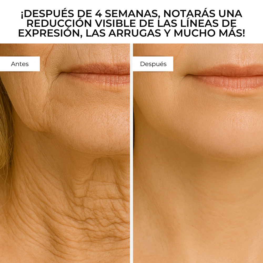 DermaGlow™ – Sistema Avanzado de Microinfusión Facial con ácido hialurónico