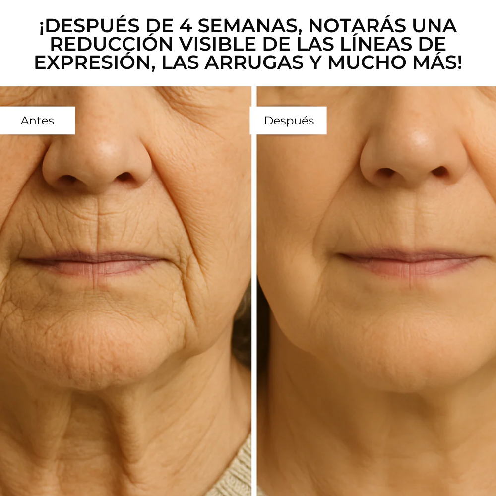 DermaGlow™ – Sistema Avanzado de Microinfusión Facial con ácido hialurónico